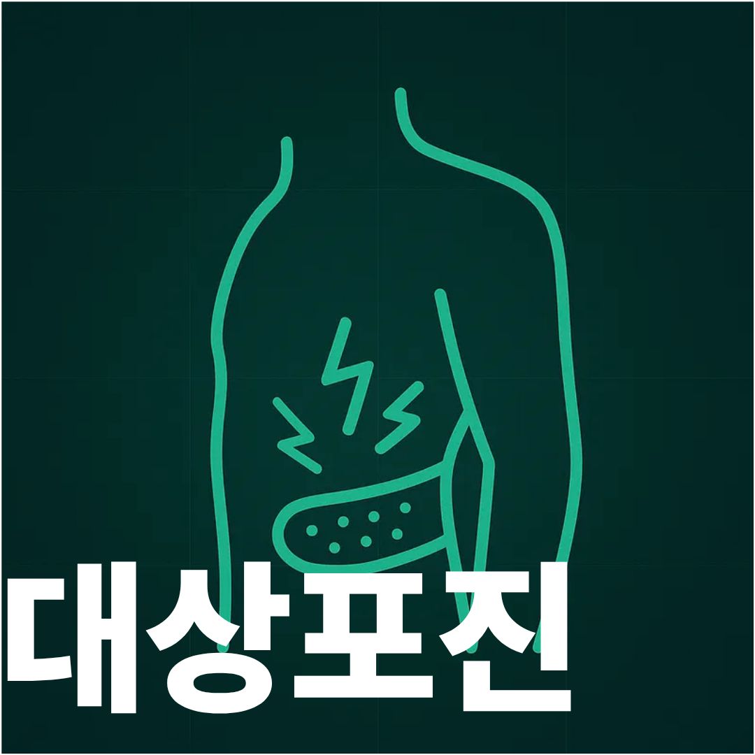대상포진 표지사진