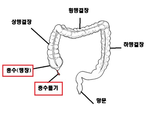 맹장염 대략적인 해부학이미지