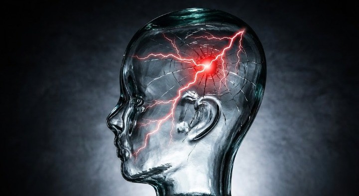 뇌에 충격을 받는 이미지