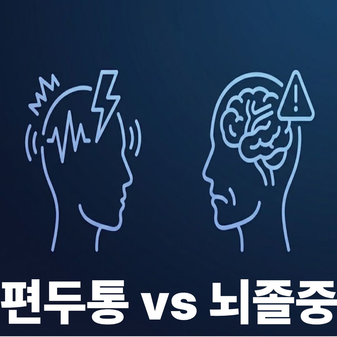 편두통vs뇌졸중 썸네일이미지