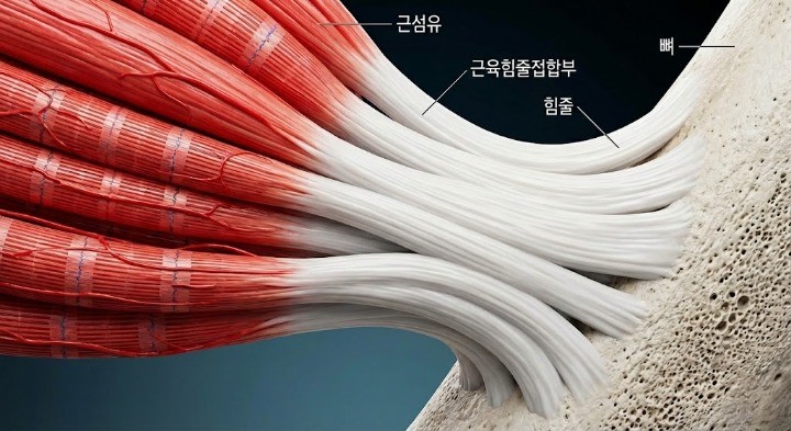 근육과 힘줄이 이행되면서 뼈에 붙는걸 보여주는 이미지