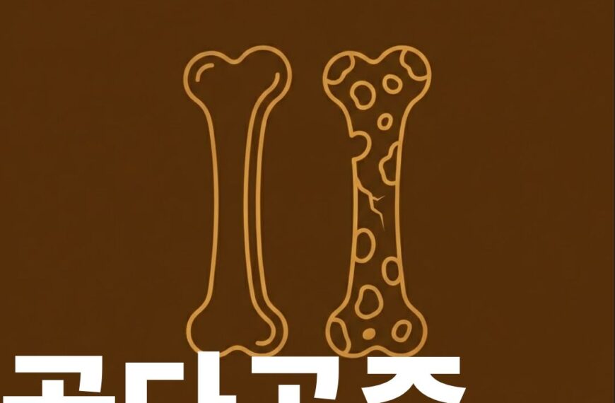 골다공증 썸네일이미지