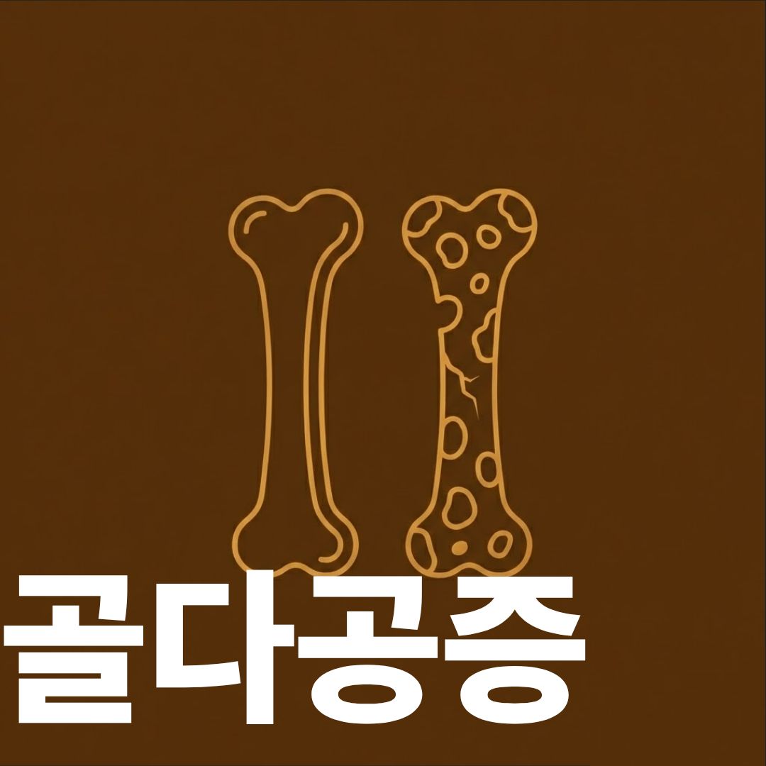 골다공증 썸네일이미지