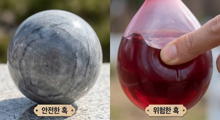 우리의 뇌는 딱딱한 공이 아니라 물속에 들어있는 물풍선이라는 이미지
