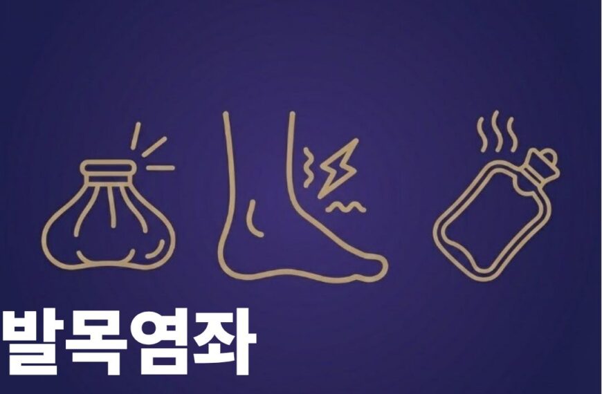 발목염좌 찜질 썸네일이미지