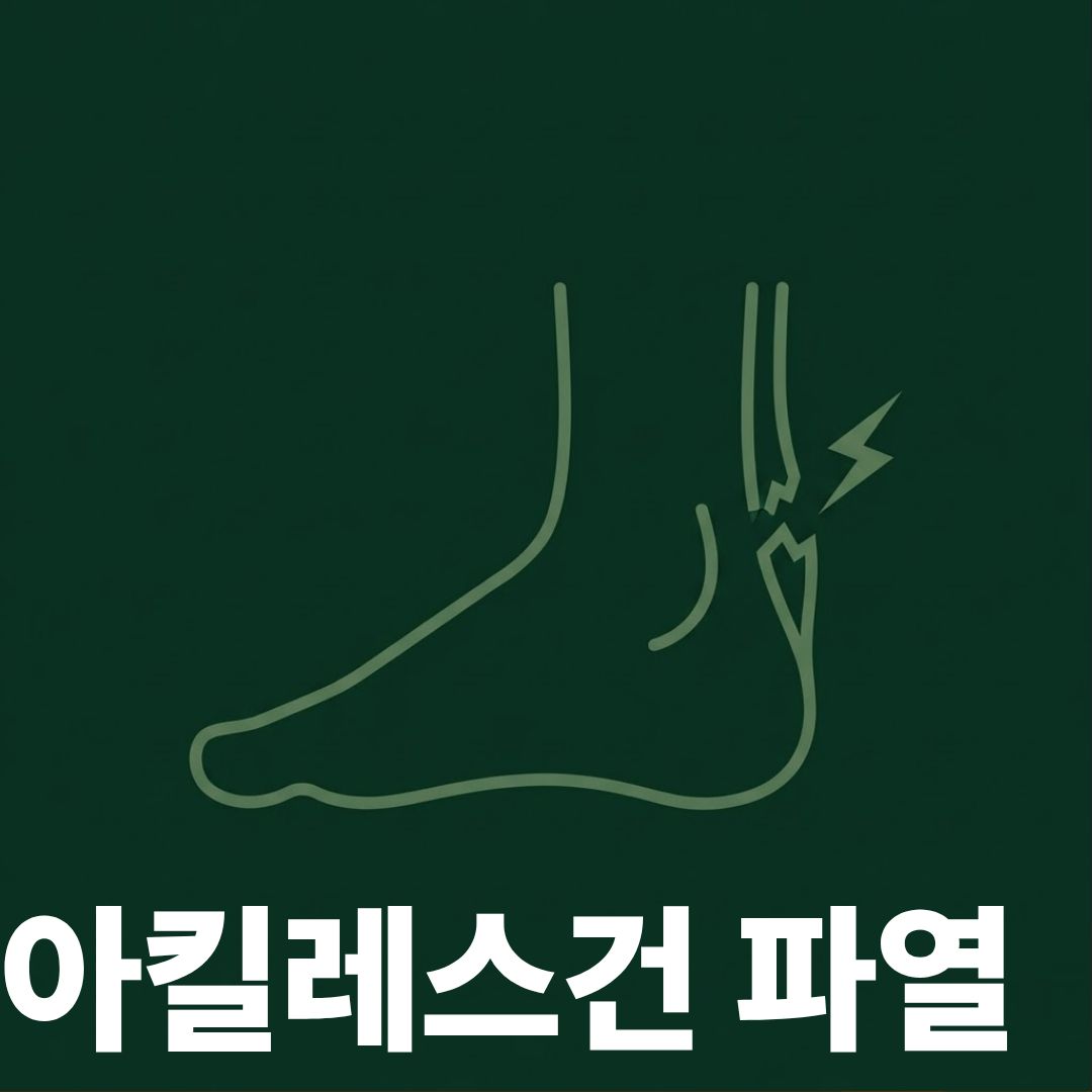 아킬레스건파열 썸네일